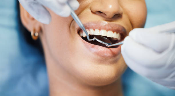 Best Pediatric Emergency Dentist in Bainbridge Island, WA